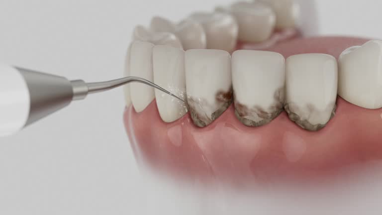 Trusted Wisdom Tooth Removal service in Centerville, PA - Dentist Open Now